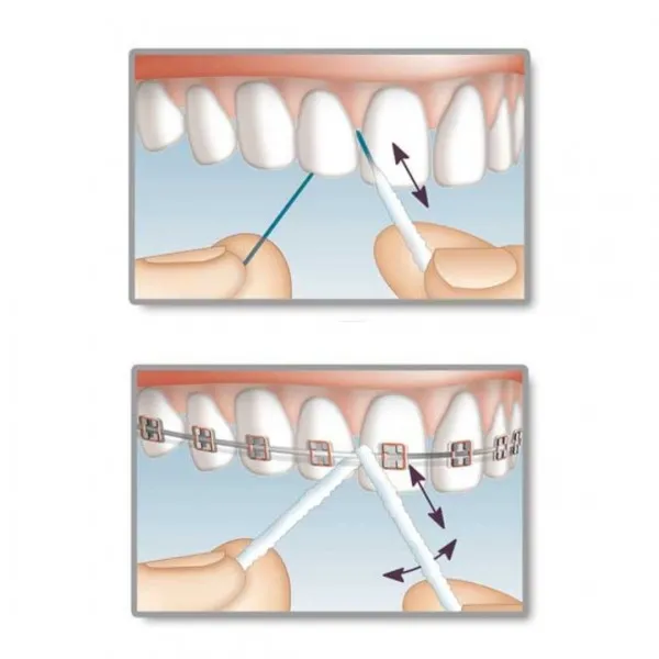 Флос Mirafloss Implant CHX Medium (2,2 mm) — Photo 3